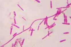 botulinum botulinum