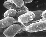 The 4 Most Common Food Illnesses; Identify, Treat & Prevent
